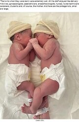 【海外発！Breaking News】確率8万分の1、卵膜に包まれて双子の片割れが誕生 医師も「美しい！」と興奮（スペイン）＜動画あり＞