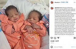 【海外発！Breaking News】3回連続で双子を出産した女性 担当医師「とても信じられない」と仰天（米）
