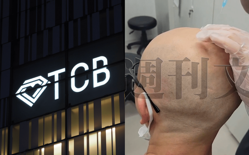 爆笑しながらスキンヘッドに注射…美容外科大手・TCB「医師の悪ふざけ動画」が流出！ 看護師「ヤバいなと思った」《不適切動画入手》