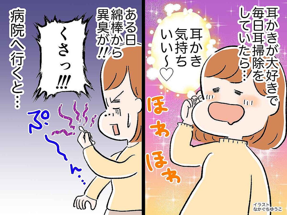 ＜耳かき中毒が招いた悲劇＞耳かき中に【綿棒から異臭】さらに高熱まで！ まさかの『病気』に要注意