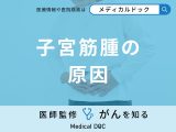 「子宮筋腫の主な5つの原因」はご存知ですか？セルフチェック法も医師が解説！