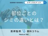 顔だけじゃない? 手や足にもできる「シミ」の部位ごとの原因を医師に聞く