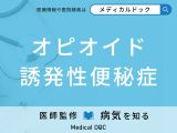 「オピオイド誘発性便秘症」を発症する原因をご存じですか？【医師監修】