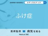 「ふけ症」の原因・症状をご存じですか？ なりやすい人の特徴を併せて医師が解説