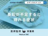 「亜鉛」が不足すると現れる症状はご存知ですか？【管理栄養士監修】