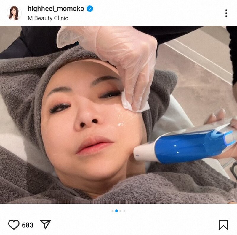ハイヒール・モモコ「メンテナンスは大事!」美容施術中の“半目写真”で力説「仕事と思ってます」