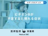 「ビタミンBが不足すると現れる症状」はご存知ですか?ビタミンBが多い食品も解説!
