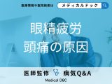 「眼精疲労で頭痛が起きやすい原因」とは?発症しやすい人の特徴も解説!【医師監修】