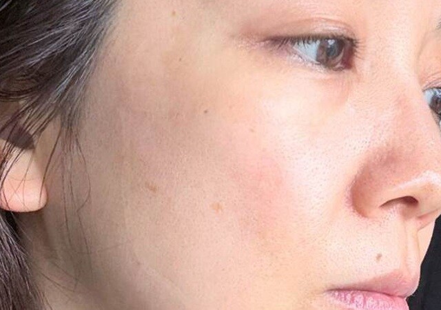 今話題の薄肌って?プロが教える薄肌さんのスキンケアのコツ