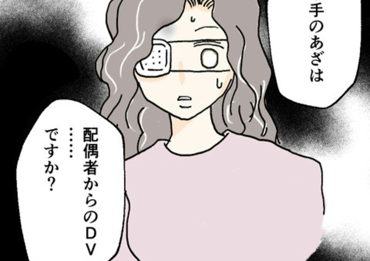 眼帯の彼女に禁断の質問「DVですか?」|夫への復讐、手伝います【ママリ】