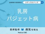 「乳房パジェット病」の初期症状をご存じですか? 早期発見のポイントを併せて医師が解説