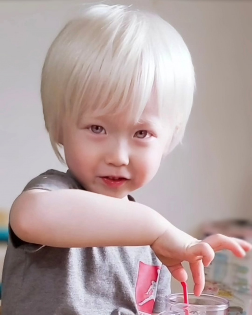 アルビノの小学生息子に“かっこいいやん!”、SNSで広がる理解 過去には「病気なの? かわいそうね」の言葉に傷ついたことも