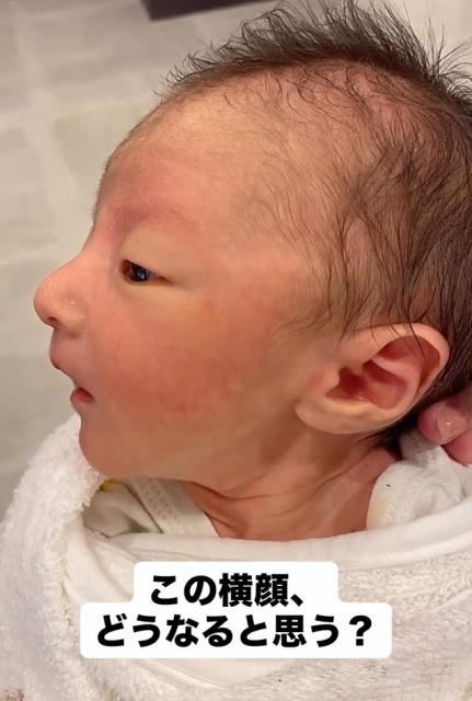 パパ譲りの鼻高ベビー、1年後の成長した姿に800万再生「骨格が異次元」「もうイケメンやないか!」